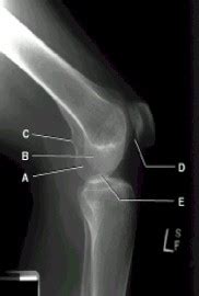 Ch Cervical Spine Ch Lower Extremity Unit Test Pelvis Hip Ch