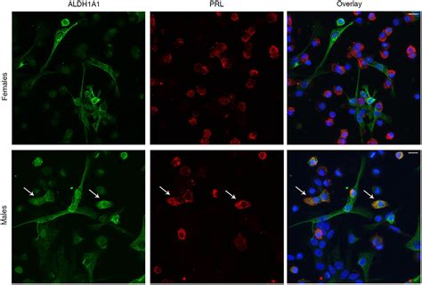 Frontiers Cell Type And Sex Dependent Transcriptome Profiles Of Rat