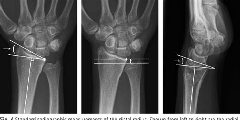 Figure 1 From UvA DARE Digital Academic Repository 3 D Imaging In