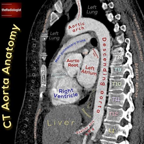 Check Out This Sagittal View Of A Ct Aorta ⁣ ⁣ Take Note Of ⁣ ⁣ 📝we