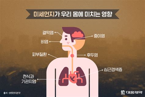 미세먼지 심한 날 내 몸을 지키는 건강 관리법은 대웅제약 뉴스룸