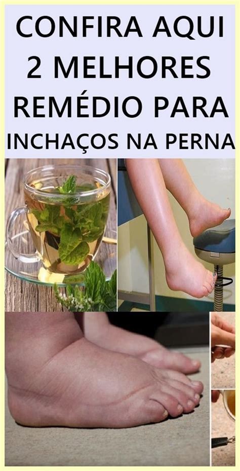 As Melhores Op Es De Rem Dio Caseiro Para Incha O Nas Pernas Em