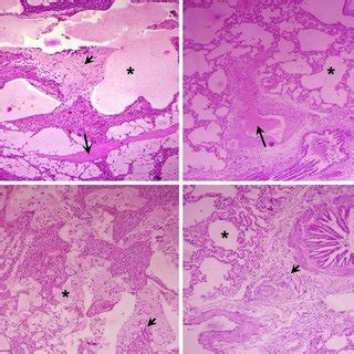 (PDF) Pathological and clinical investigations of an outbreak of Blackleg disease due to C ...