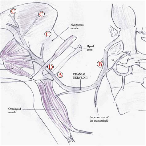 Anatomic Locations Of Hypoglossal Nerve Injury A Nerve Compression