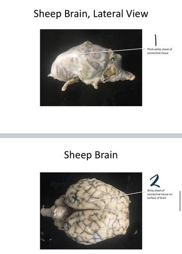 Brain Anatomy Sheep Brain Flashcards Quizlet