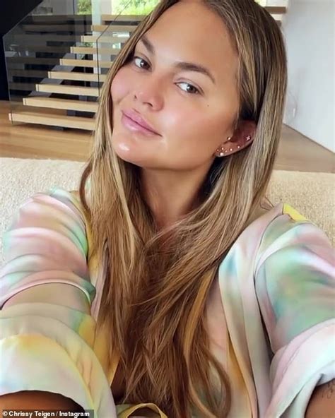 Chrissy Teigen Denies Getting Filler In Her Cheeks After Buccal Fat