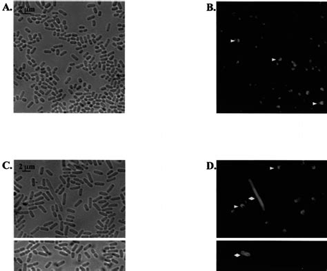 Localization Of Icsa On S Flexneri Grown In Vitro Phase Contrast And