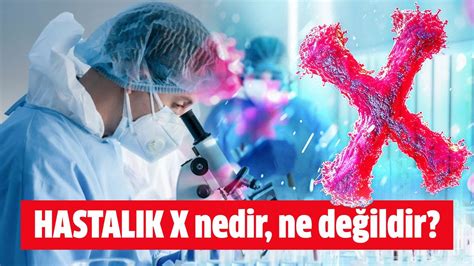 HASTALIK X nedir ne değildir Hürsöz Gazetesi