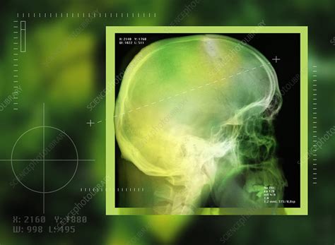 skull  ray stock image p science photo library