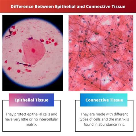 Tissu Pith Lial Vs Tissu Conjonctif Diff Rence Et Comparaison