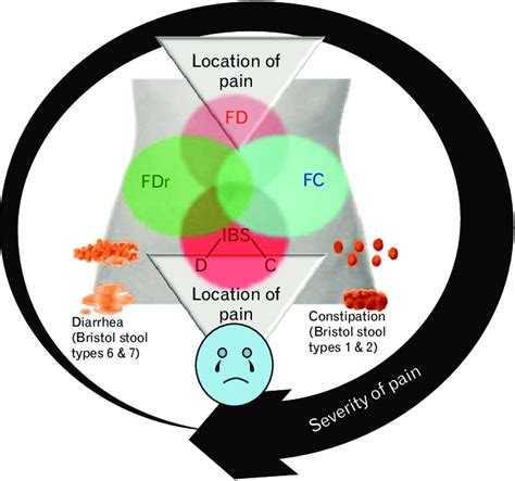 Overlap Between Common Functional Gastrointestinal Disorders Fd Download Scientific Diagram