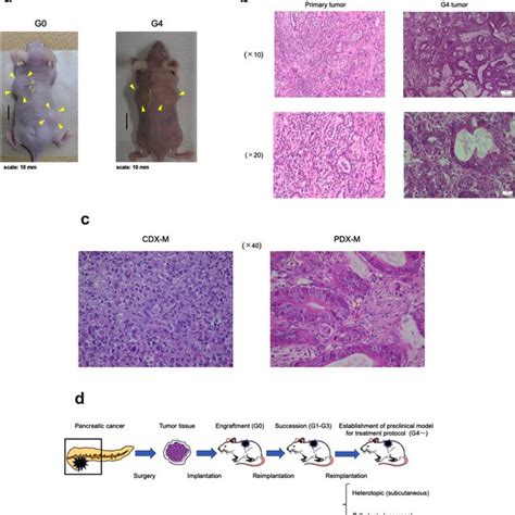 Establishment Of A Patient Derived Xenograft Mouse Model Resected