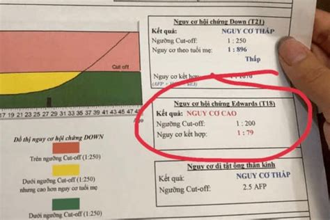 Xét Nghiệm Máu Biết Trai Hay Gái Tìm Hiểu Phương Pháp Chính Xác Và An Toàn