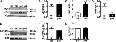 Mutation E169k In Junctophilin 2 Causes Atrial Fibrillation Due To