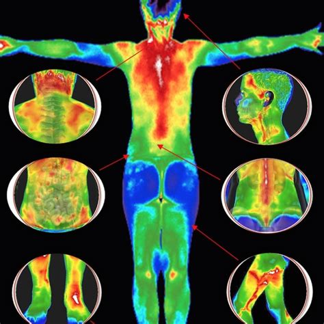 Infrared thermography (IRT), thermal imaging, and thermal video are ...