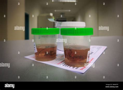 Tissue Samples Are Placed In Formalin For Subsequent Examination By A