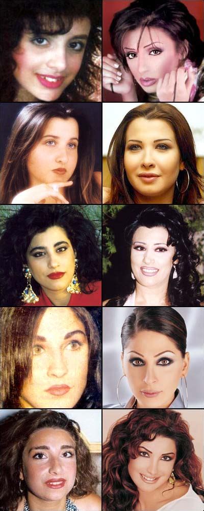 صور الفنانات قبل وبعد عمليات التجميل 2013