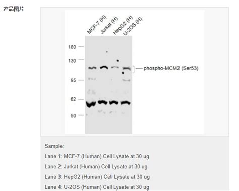 磷酸化mcm2蛋白抗体 北京拜尔迪生物技术有限公司