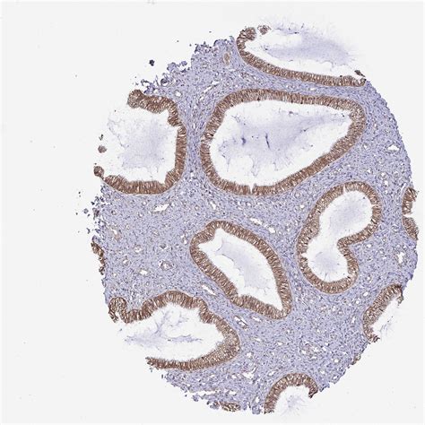 Tissue Expression Of Trim44 Staining In Cervix The Human Protein Atlas