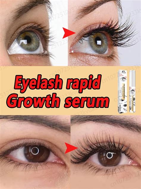 Rapid Eyelash Growth Serum Grows Eyelashes And Increases Eyelash