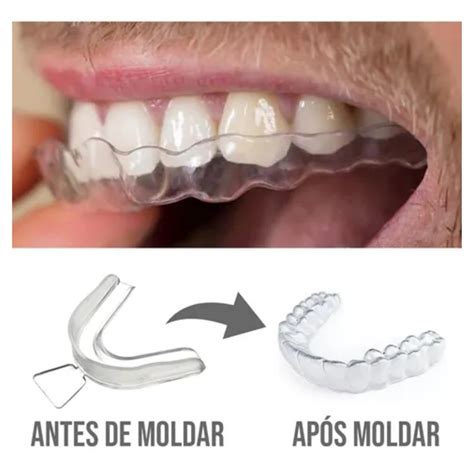 Aparelho Móvel Transparente Invisível Bruxismo Anti Ronco de Silicone