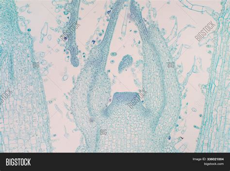 Shoot Meristem Tissue Image & Photo (Free Trial) | Bigstock