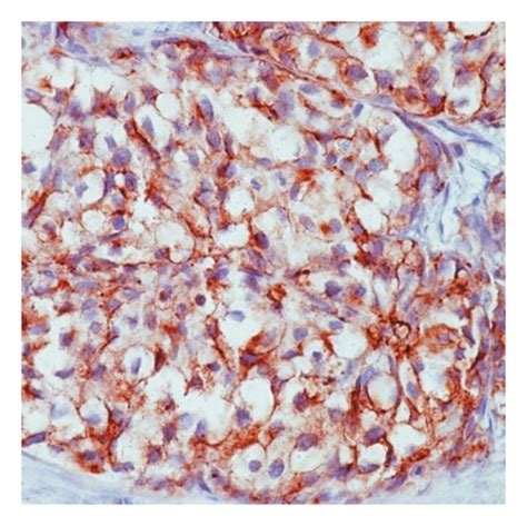 Epithelial Membrane Antigen Ema Ab Mouse Monoclonal Antibody Epredia