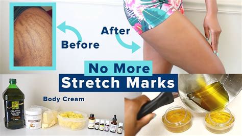 How To Make A Stretch Marks Removal Skincare Cream Scrub Body Oil