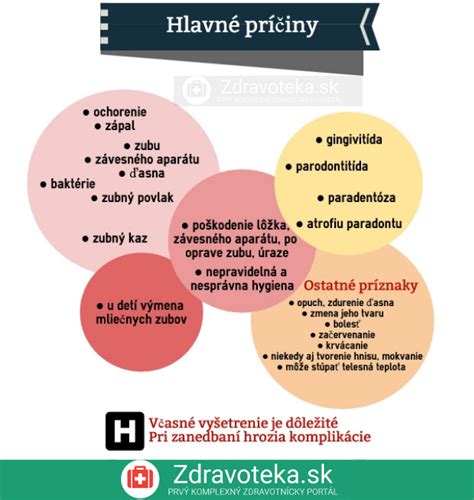 Infografika Aké sú hlavné príčiny kývania zubov Zdravoteka sk