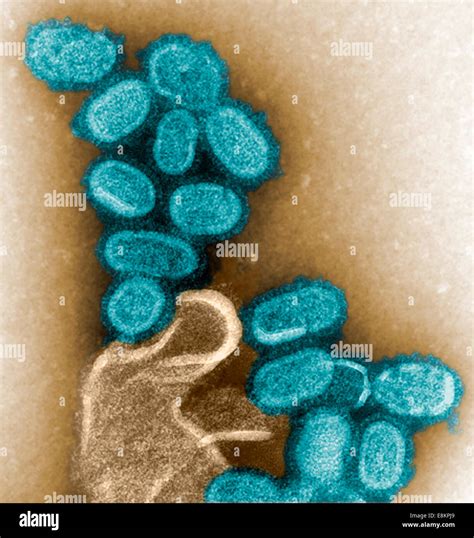 This Colorized Negative Stained Transmission Electron Micrograph Tem