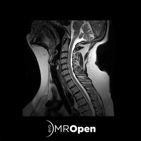 Mropenevo The Best Mri Experience