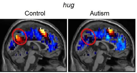 mri autism social interaction – Neuroscience News