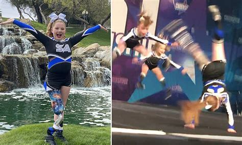 11-year-old girl with one leg becomes a star cheerleader | Daily Mail Online