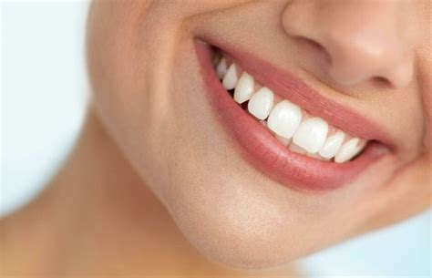 Premium Dental Veneers In Thousand Oaks Ca