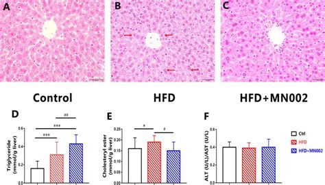 A H E Histological Cross Sections Of Liver In The Control Group B