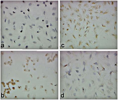 Immunocytochemistry Analysis On The Expression Of Pedf A C And Vegf