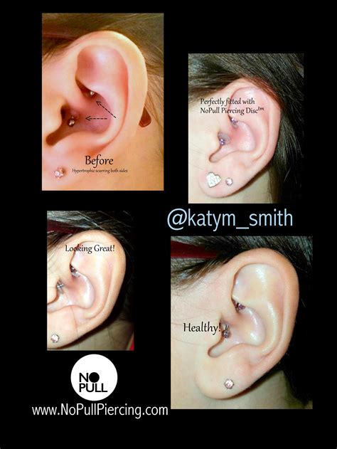 Look At This Daith With The Dreaded Bump See How As Each Week Goes