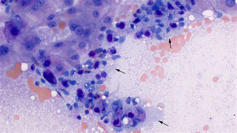 Liver Histology Kupffer Cells