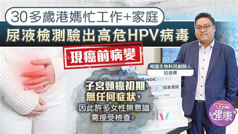 子宮頸癌｜30多歲港媽忙工作家庭 尿液檢測驗出高危hpv病毒現癌前病變