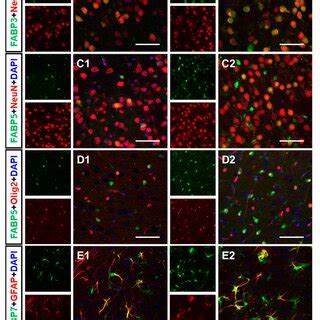 Immunofluorescence Of FABP3 FABP5 And FABP7 In The Cortexes Of Sham