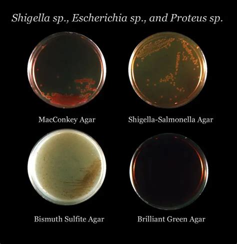 Bismuth Sulphite Agar Bsa Composition Principle Preparation