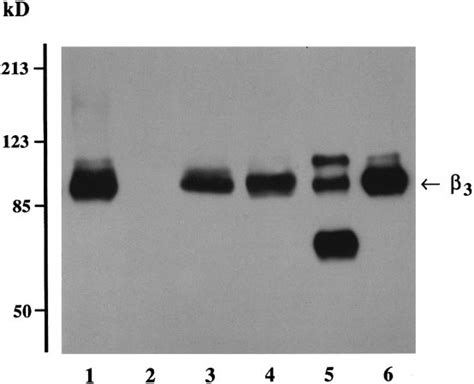 Immuno Blot Analysis Of Cho Cells Transfected With Human Download