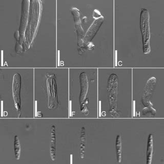 H Juliae A B Asci And Paraphyses C H Asci I Ascospores Bar A H