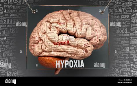 Hypoxia Anatomy Its Causes And Effects Projected On A Human Brain