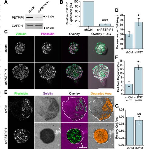 Figure 1 From PHAGOCYTES GRANULOCYTES AND MYELOPOIESIS The F BAR