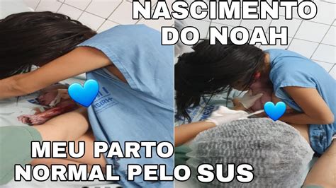 Meu Parto Normal Pelo Sus De Semanas Nascimento Do Noah