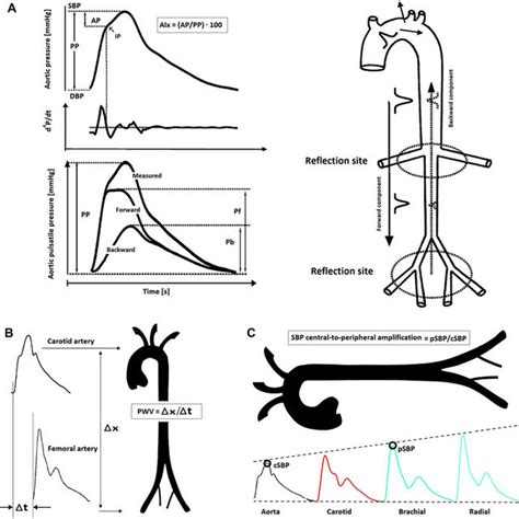 Central Aortic Pulse Wave Analysis Pwa Aortic Pressure Can Be