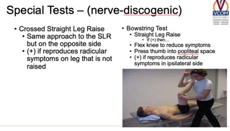 Lasegue Test Straight Leg Raise Test OrthoFixar 2023 49 OFF