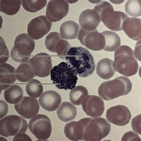 Blood Smear Diagram Quizlet