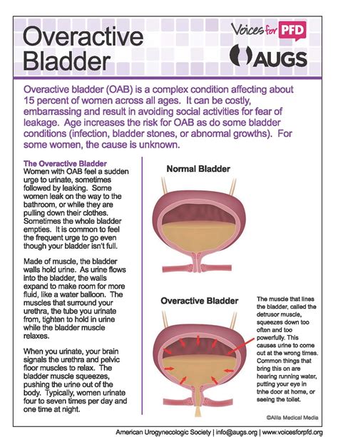 Patient Fact Sheets Augs